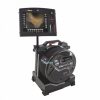 Vuman E3 Videoscope